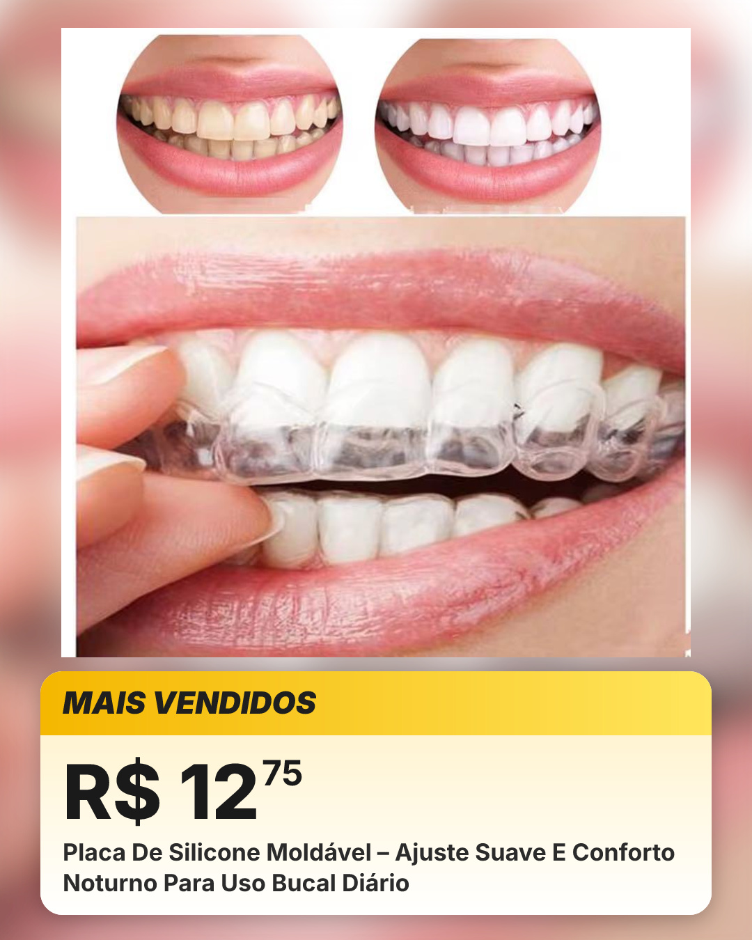 Placa De Silicone Moldável – Ajuste Suave E Conforto Noturno Para Uso Bucal Diário